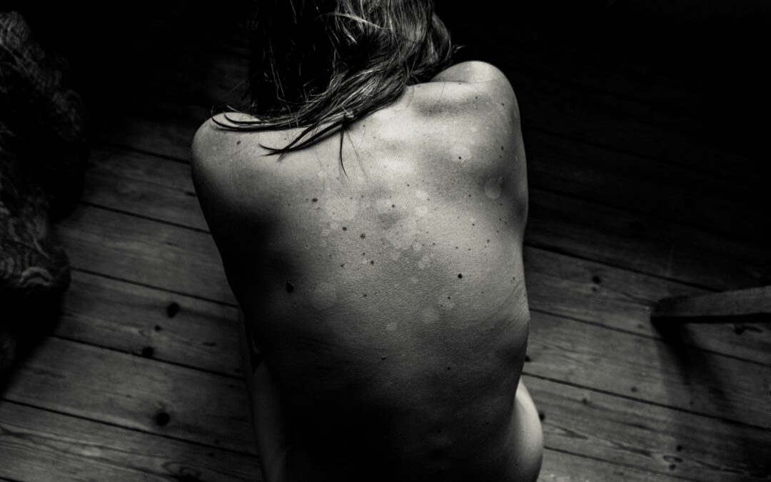 Ep. 84: Pain Isn’t Just Physical