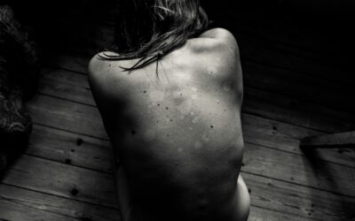 Ep. 84: Pain Isn’t Just Physical