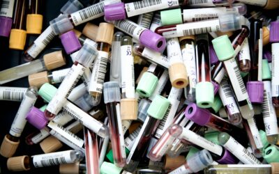 Ep. 83: Normal Labs, No Answers?