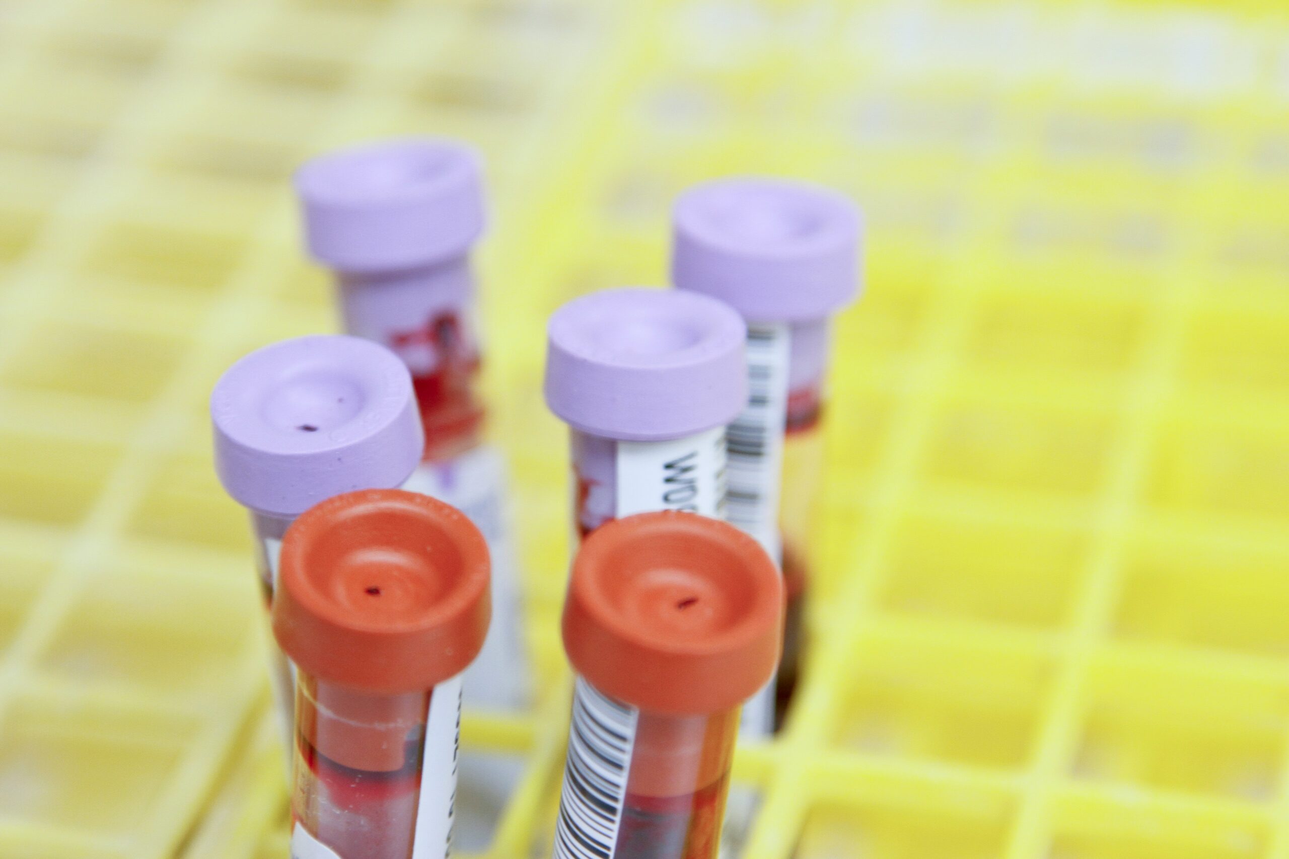 Ep. 145: What Your Doctor is Missing in Your Fertility Testing